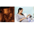 Ultrazvuk 4D v těhotenství fotografie i záznam  | Slever