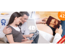 4D ultrazvuk | Hyperslevy