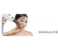 Exkluzivní kosmetické ošetření - Carbon Peel laser | Slevici