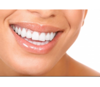 Profesionální bělení zubů | Fajn Slevy