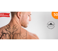 Odstranění tetování metodou Rejuvi Tattoo removal | Hyperslevy